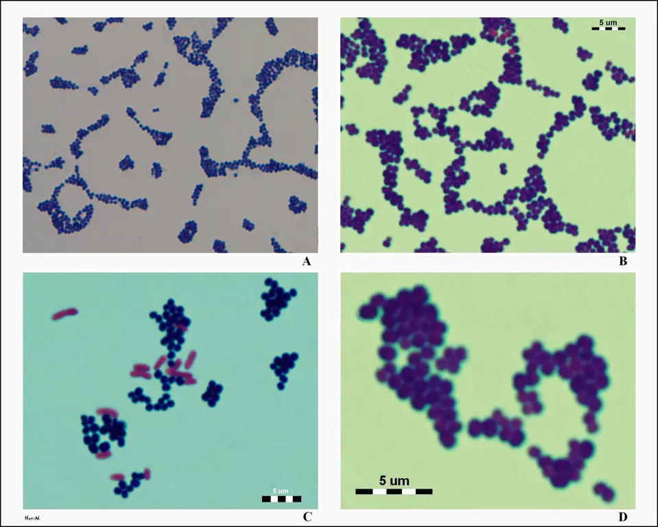 Gambar mikroskopis bakteri Staphylococcus aureus