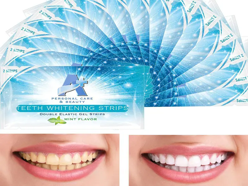 Gambar berbagai macam whitening strips untuk memutihkan gigi.