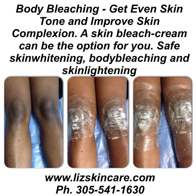 Berbagai macam produk body bleaching