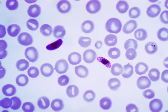 Gambar Plasmodium