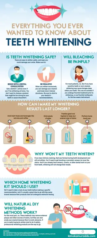 Perbandingan antara bleaching dan veneer